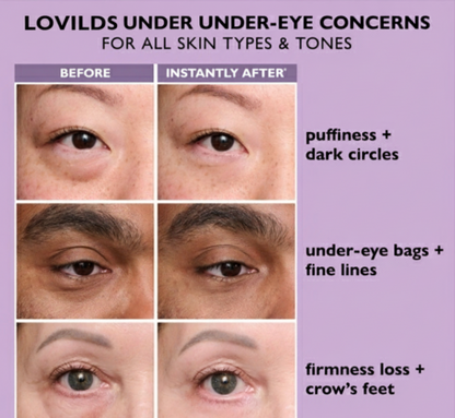 LOVILDS Revitalizing Eye Essence: Reduces Dark Circles, Eliminates Fatigue, and Brightens Tired Eyes.