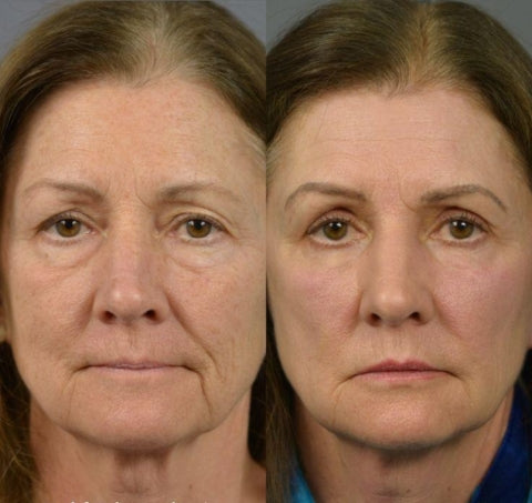 LOVILDS Revitalizing Eye Essence: Reduces Dark Circles, Eliminates Fatigue, and Brightens Tired Eyes.